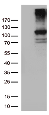 RB1 Antibody