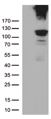 Rb Antibody
