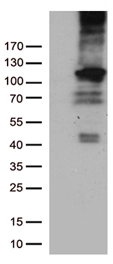 Rb Antibody