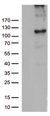 RB1 Antibody