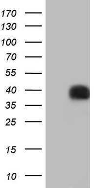 PAGE1 Antibody
