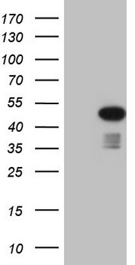 Rb Antibody