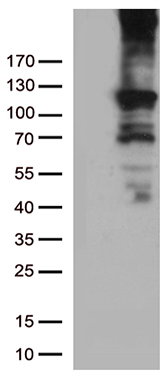 Rb Antibody