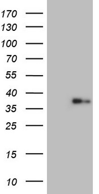 LGALS9 Antibody