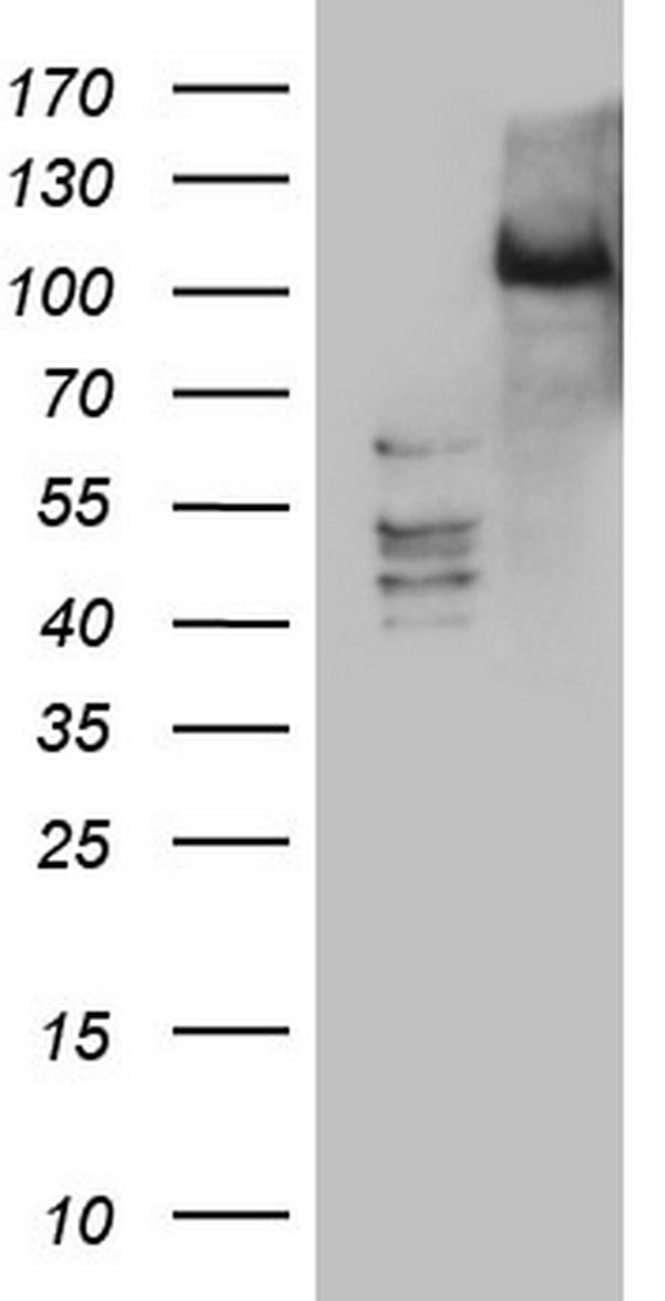 PKC nu Antibody