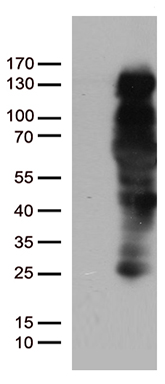 Progesterone Receptor Antibody