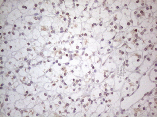 TLK2 Antibody