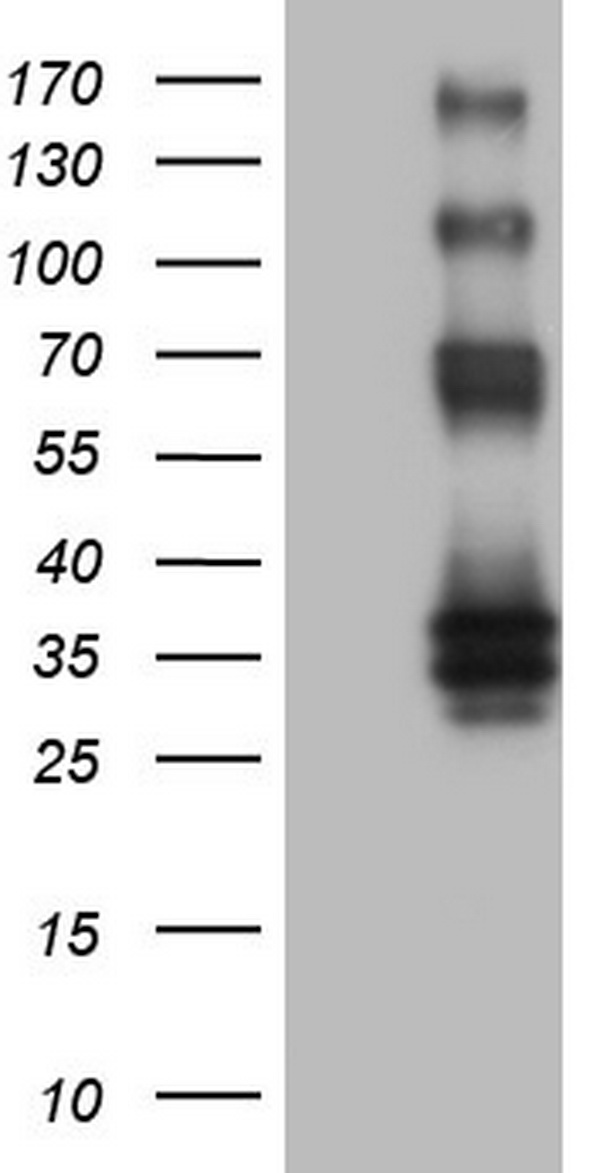 PROCR Antibody