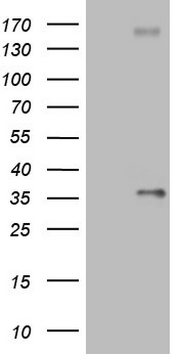 PROCR Antibody
