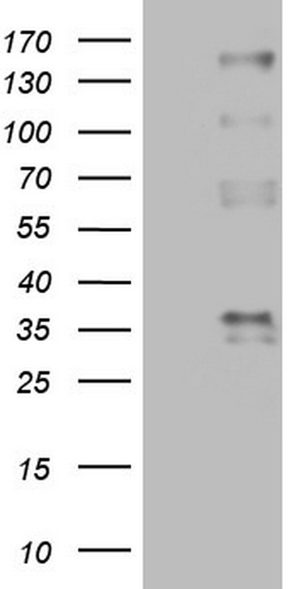 PROCR Antibody