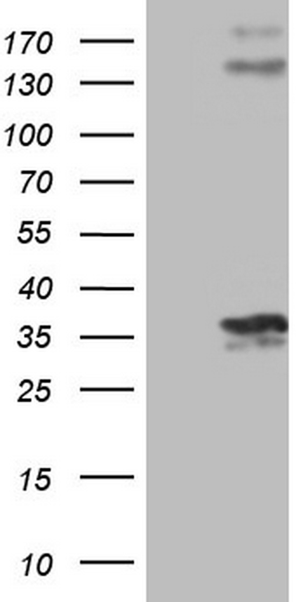 PROCR Antibody