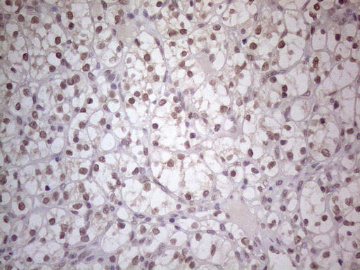 TLK2 Antibody