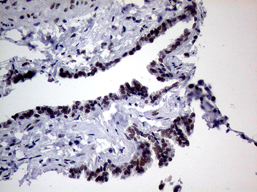 TLK2 Antibody