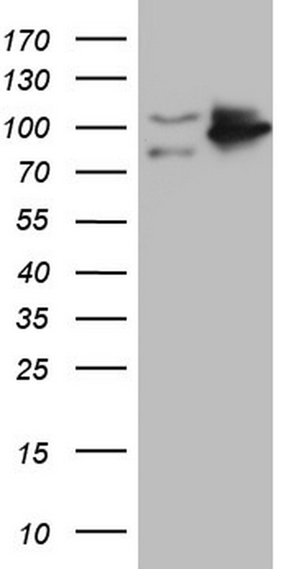 TLK2 Antibody