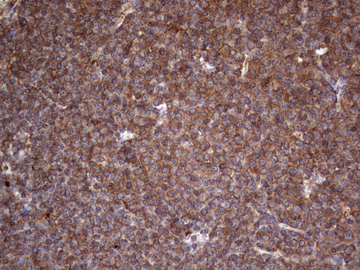 LRRTM1 Antibody