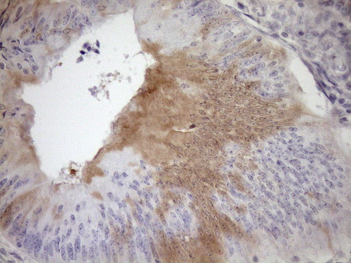 p16INK4A Antibody