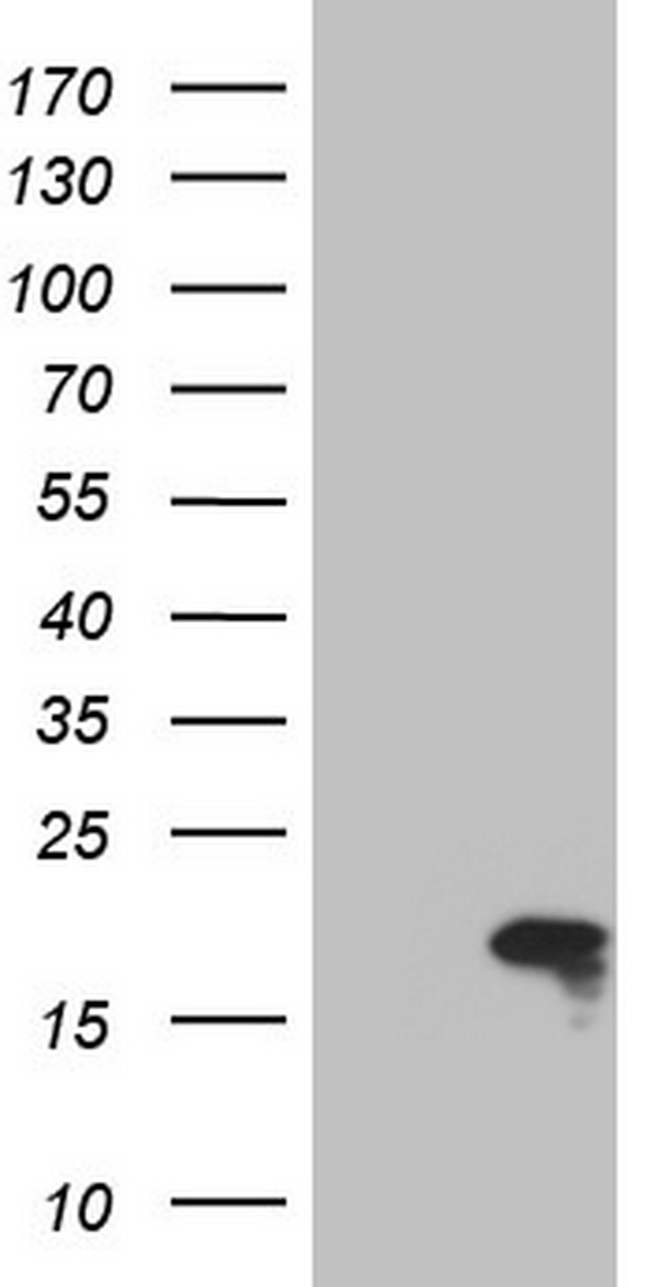 TWIST2 Antibody