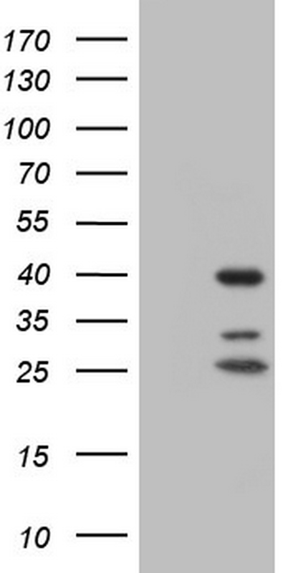 NR1I3 Antibody
