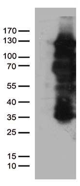 PGR Antibody