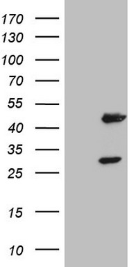 NR1I3 Antibody