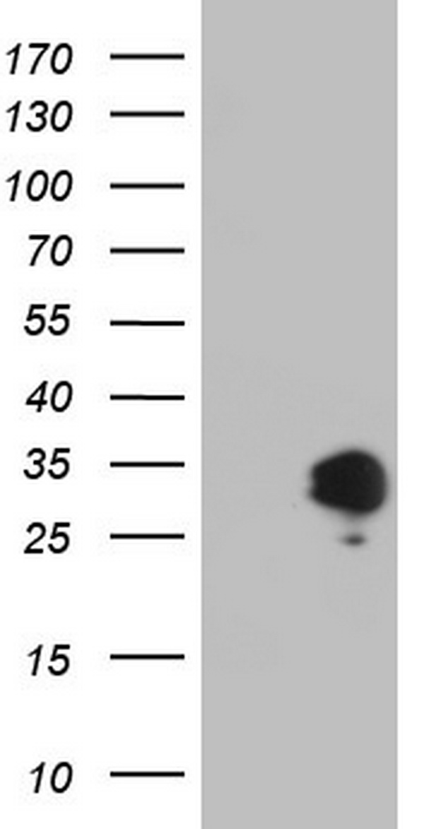 Apolipoprotein E Antibody