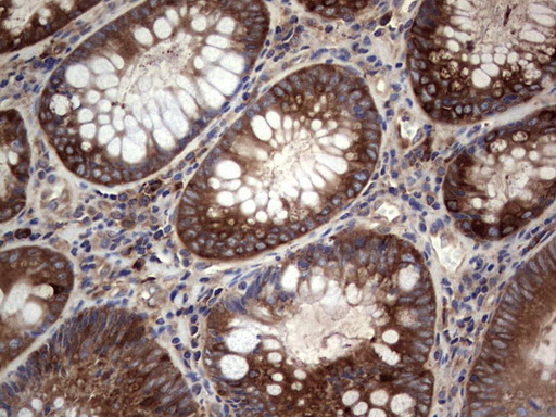 GARS Antibody