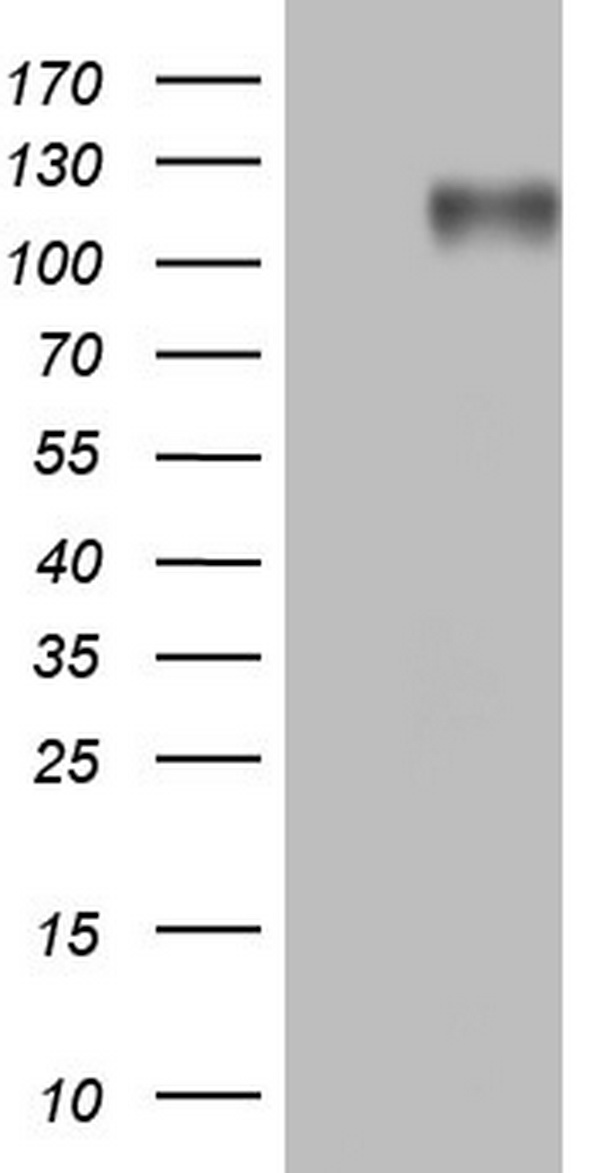 MRTFA Antibody