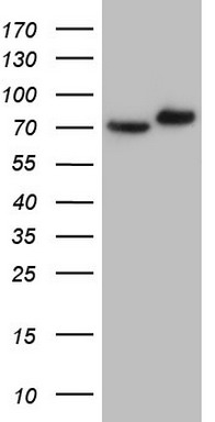 GARS Antibody
