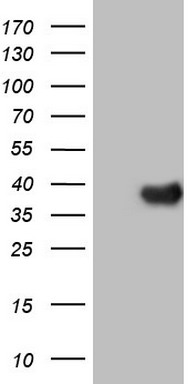 NR5A2 Antibody