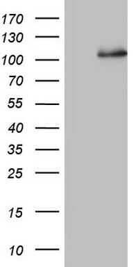CD56 Antibody