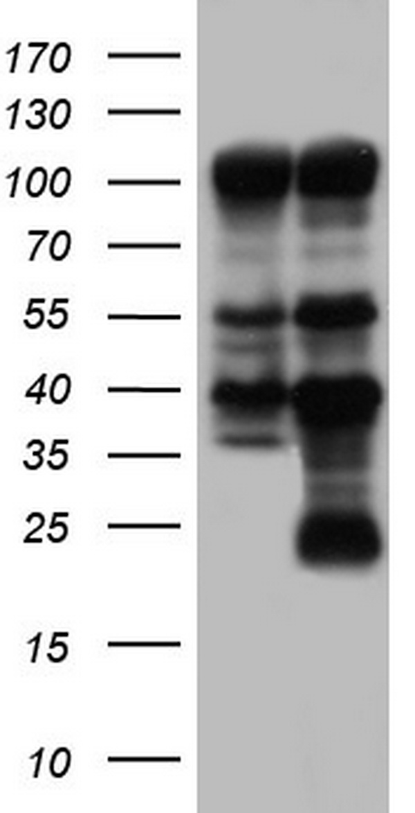 PARP1 Antibody