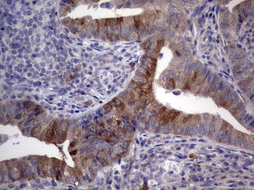 RRM1 Antibody