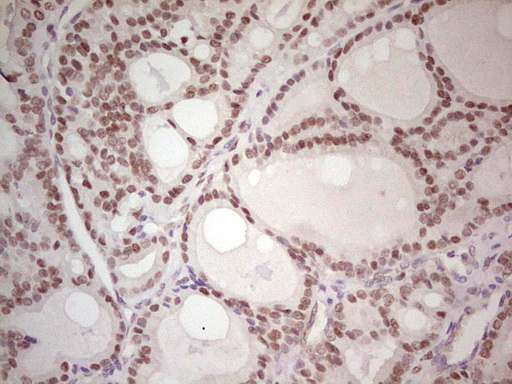 MAD2L1BP Antibody