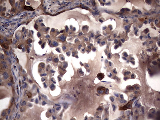 MMP7 Antibody