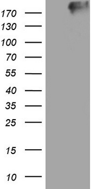 Thyroglobulin Antibody