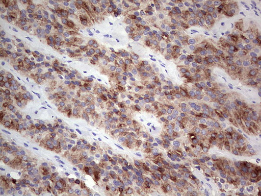 Thyroglobulin Antibody