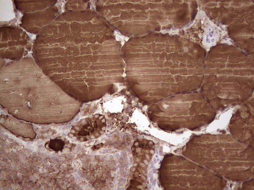 Thyroglobulin Antibody