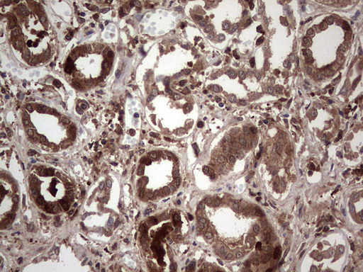 Galectin 3 Antibody