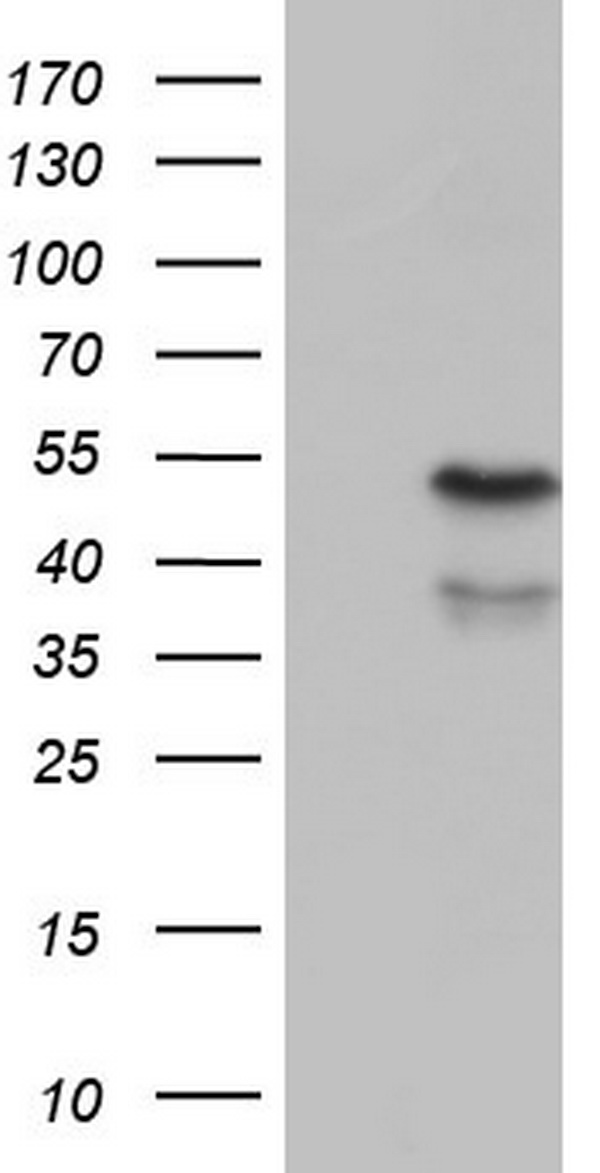 CD39 Antibody