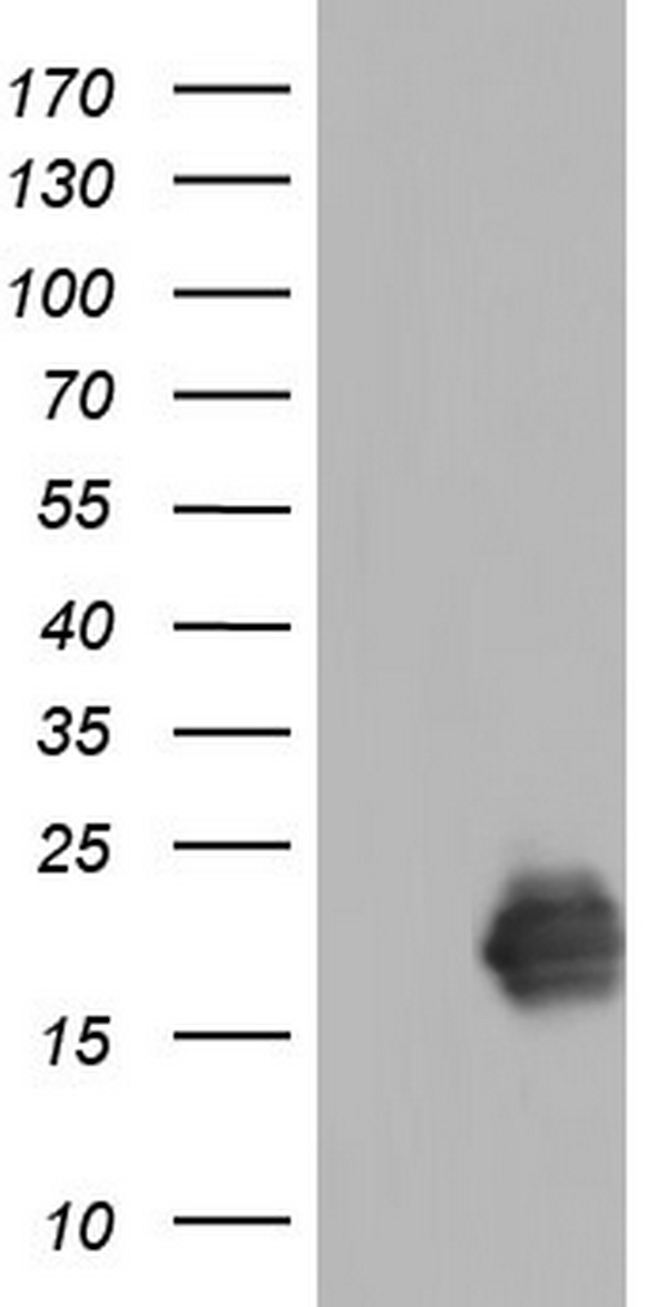 TNNC1 Antibody