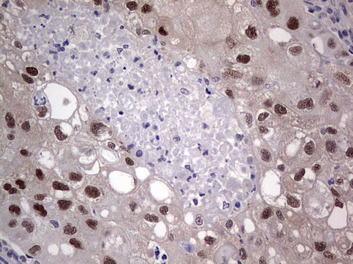 MDM2 Antibody