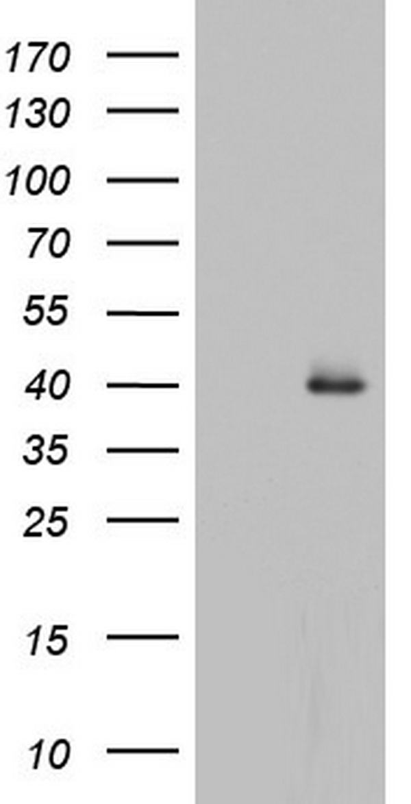 HDAC11 Antibody