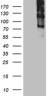 Thyroglobulin Antibody