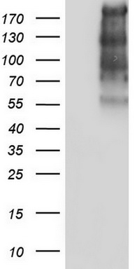 Thyroglobulin Antibody
