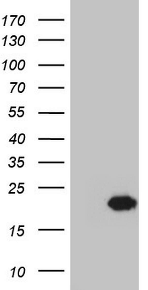 CETN1 Antibody