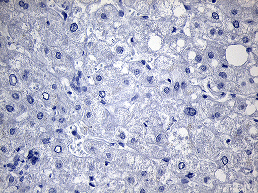 Thyroglobulin Antibody