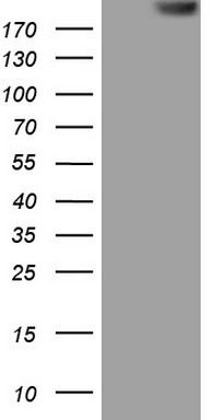 Thyroglobulin Antibody
