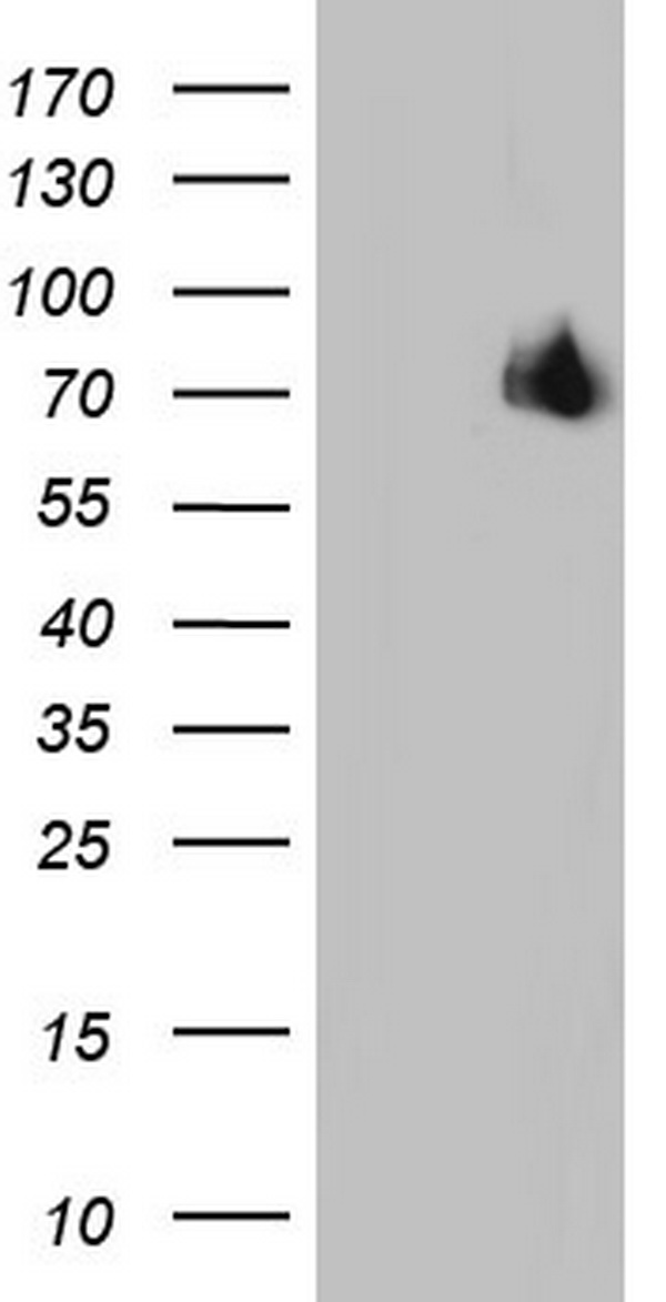 Estrogen Receptor 1 Antibody