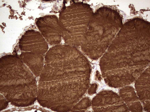 Thyroglobulin Antibody