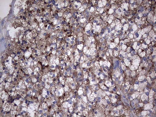 Thyroglobulin Antibody